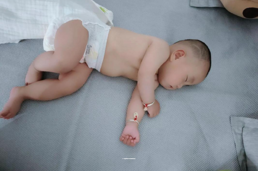 伊春宝宝头上长痱子